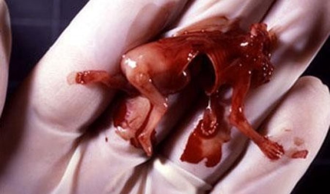 Человеческий эмбрион (27 фото)