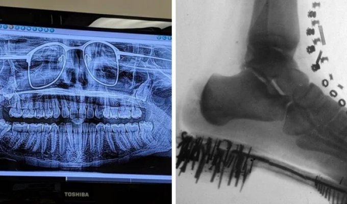 15 cases when X-rays showed that interesting things can be seen inside ordinary things (16 photos)