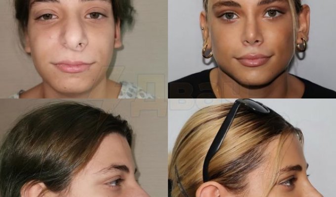 Miracles of plastic surgeons from Turkey (9 photos)