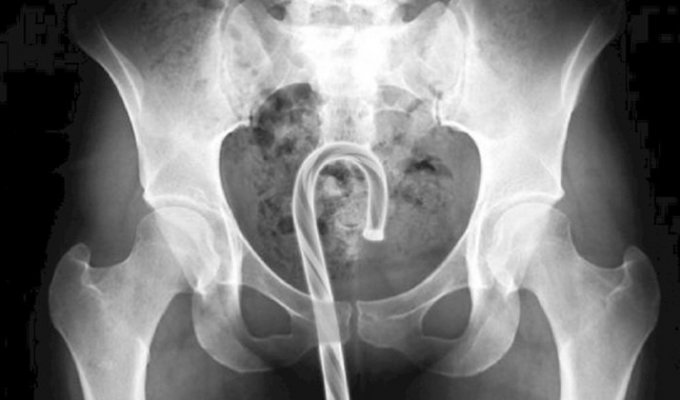 Даже врачи не сразу поверили в то, что увидели на этих рентгеновских снимках! (17 фото)