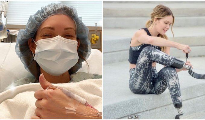 The girl lost both legs after she felt flu symptoms, but did not give up - and became an athlete (7 photos)