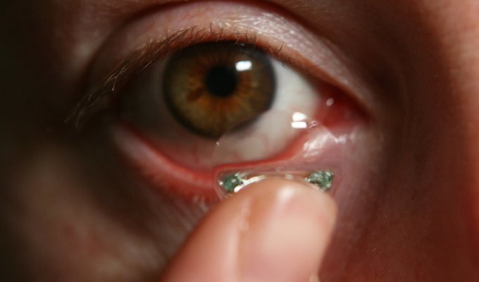27 линз в глазах: шокирующая находка британских врачей (3 фото)