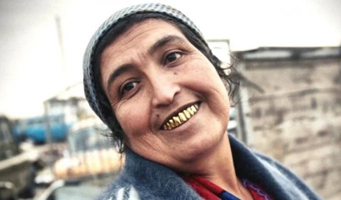 3 Reasons Why Romani People Get Gold Teeth (4 Photos)