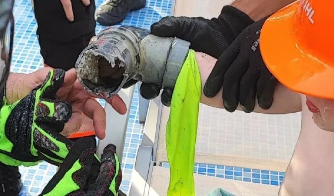 Руку мальчика затянуло в фильтр бассейна на Майорке (5 фото)