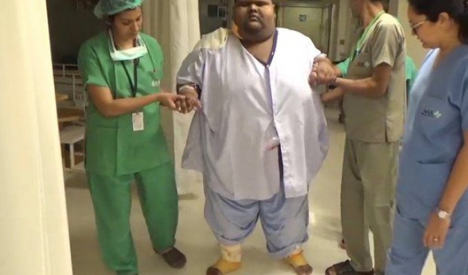 Самый толстый подросток в мире сбросил почти 64 кг после шунтирования желудка и наконец смог ходить (5 фото)