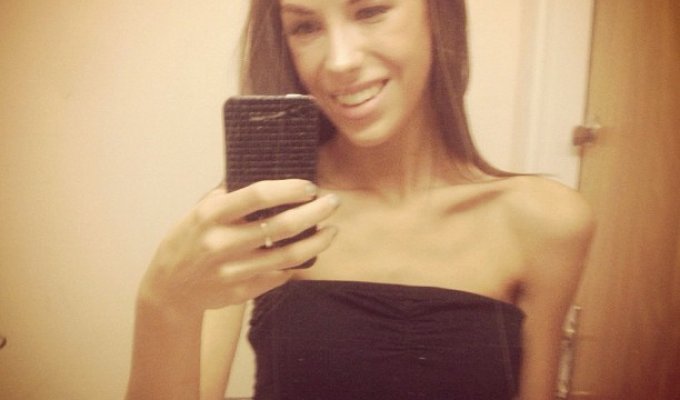 Девушка постит в Instagram свой пусть от анорексии до выздоровления (7 фото)