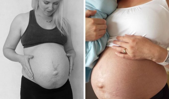 Новоиспеченная мама показала как менялось её тело в течение 14 дней после родов (7 фото)