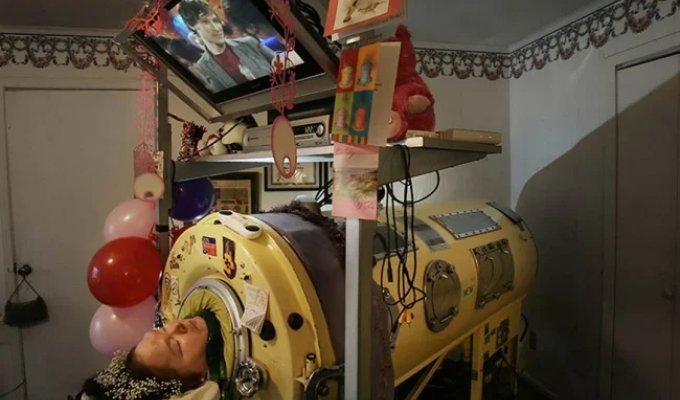 Жизнь в «танке»: женщина провела почти 60 лет в аппарате вентиляции легких (7 фото)