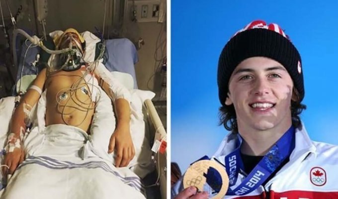 Сноубордист оправился от ужасной аварии, чтобы выиграть олимпийскую медаль (9 фото)
