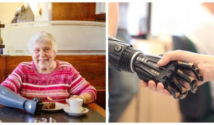 A German woman beat cancer and became the world's oldest owner of a bionic arm (5 photos)
