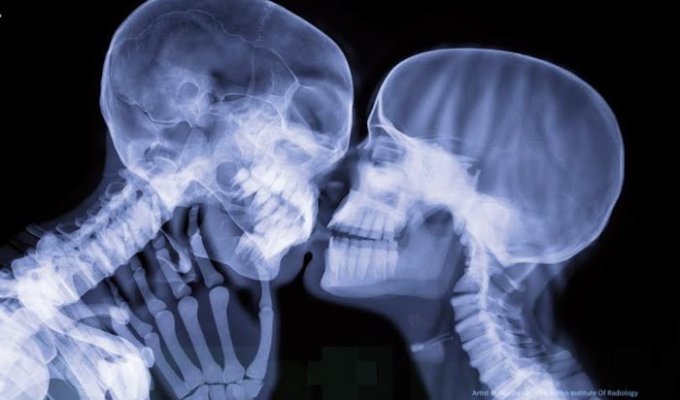 14 неожиданных фотографий: люди в рентгеновских лучах (15 фото)