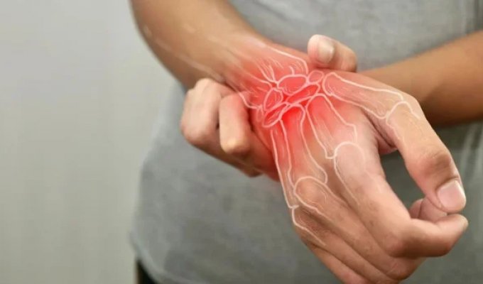 В Бразилии нашли природное средство от остеоартрита (4 фото)