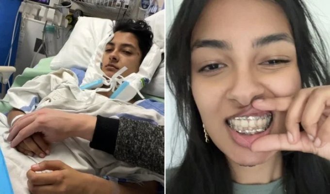 Broken Jaw in Two Places: A Student Bites Off a Candy with a Provocative Name (5 photos)