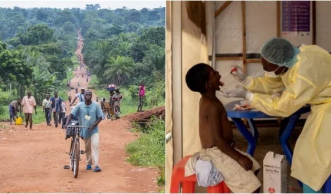 Congo intends to declare a state of emergency in connection with the new pandemic (3 photos)