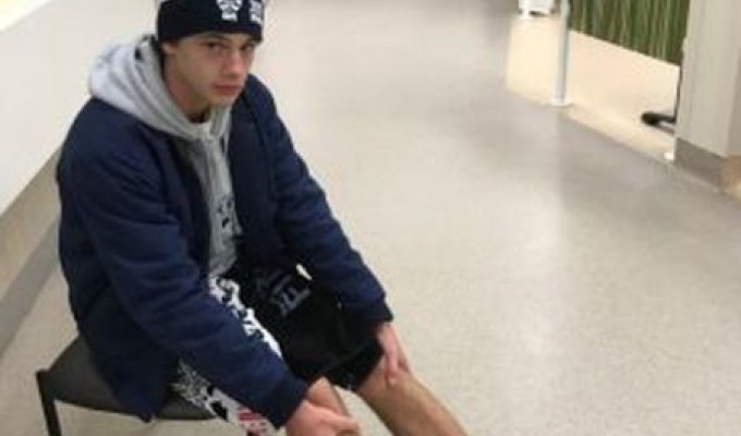 Неизвестные существа искусали ноги австралийского подростка (5 фото)