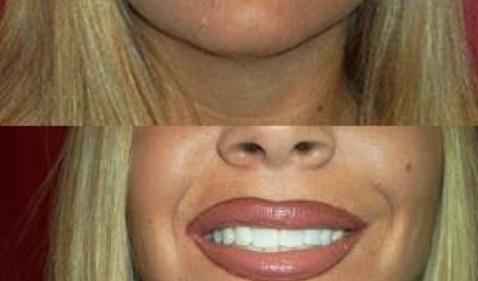Как сделать большие губы (10 фото)