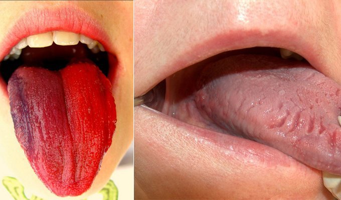 Взгляните на свой язык и вы узнаете о состоянии ваших внутренних органов (11 фото)