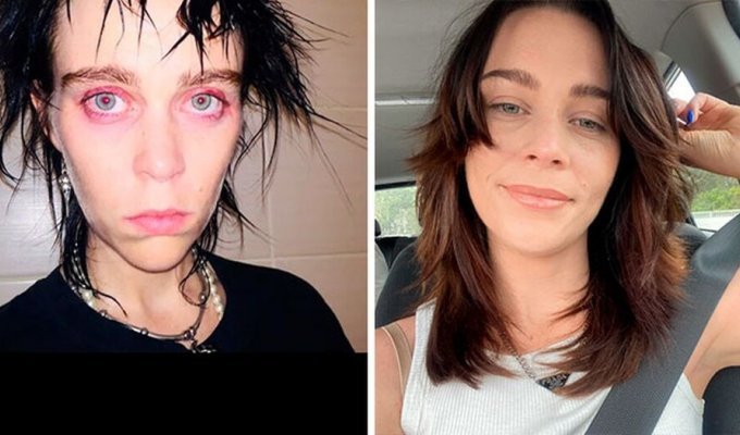 How a person changes after overcoming addiction: 25 “before and after” pictures (26 photos)