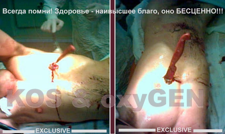 Суровые будни врачей скорой помощи